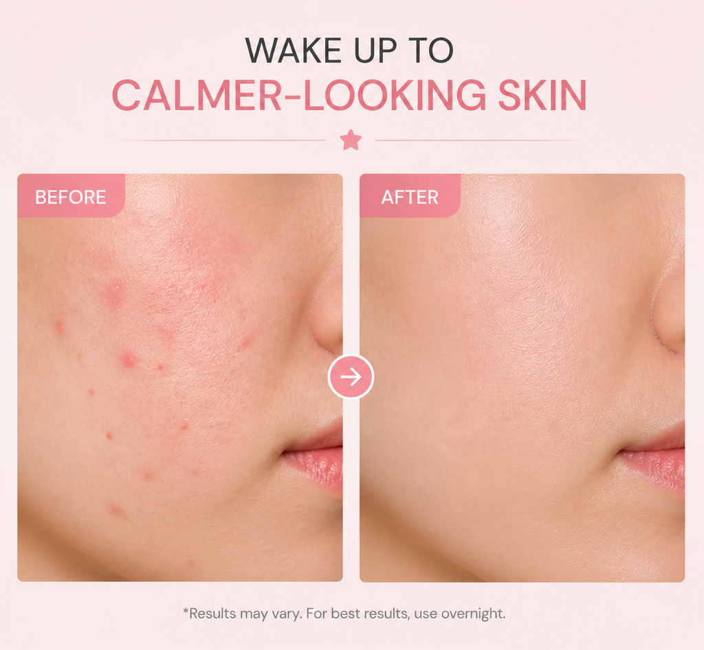 StarSpot Overnight Pimple Patches