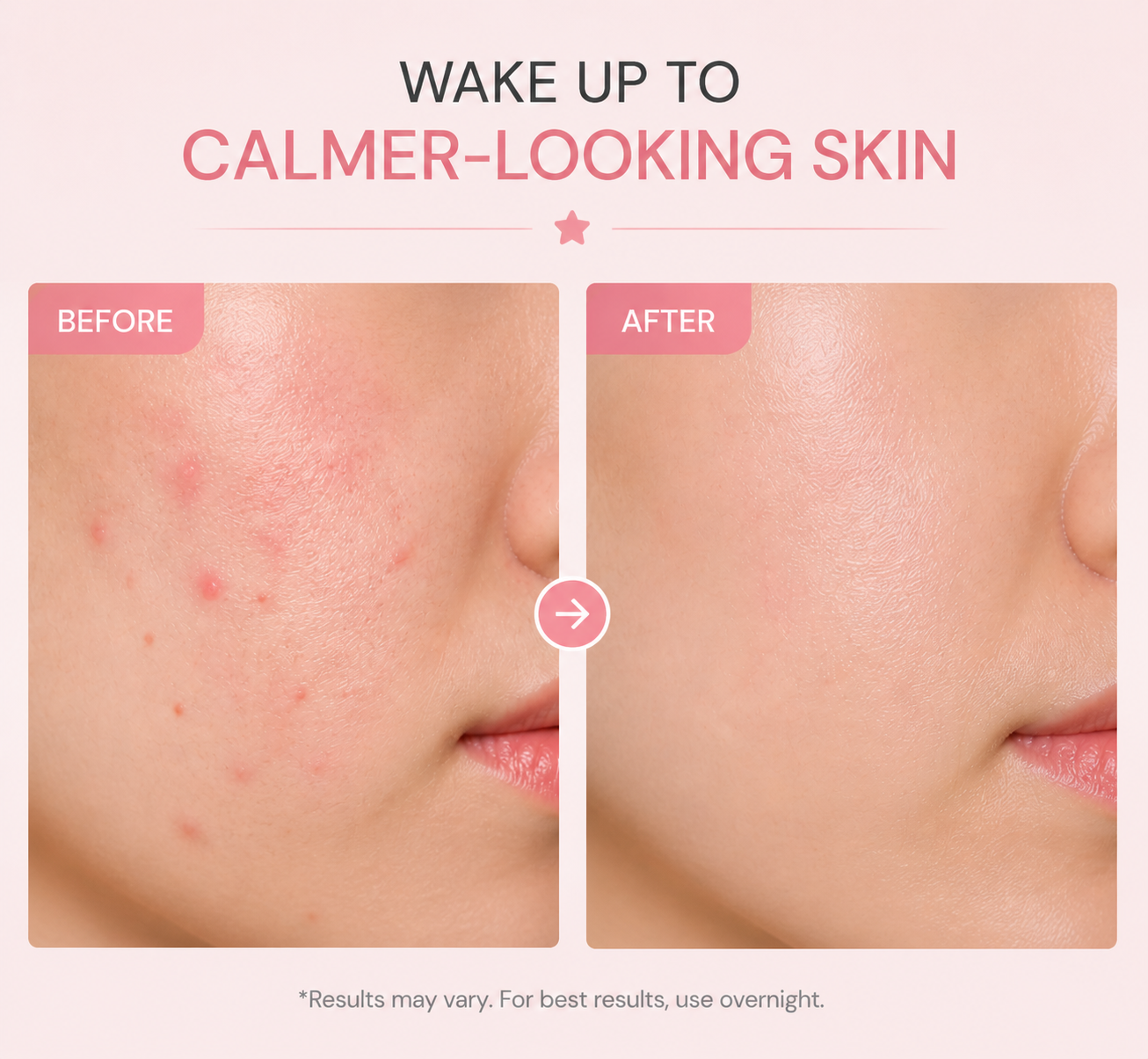 StarSpot Overnight Pimple Patches